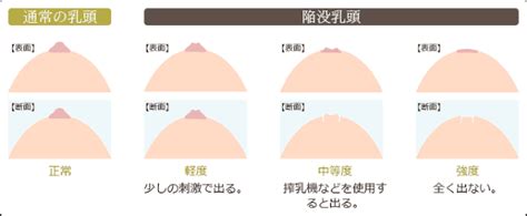 私の乳頭（乳首）の形って変？乳頭の7タイプを解説！